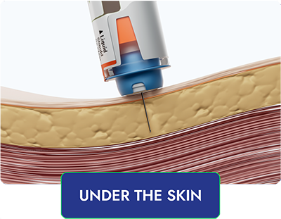 Under The Skin